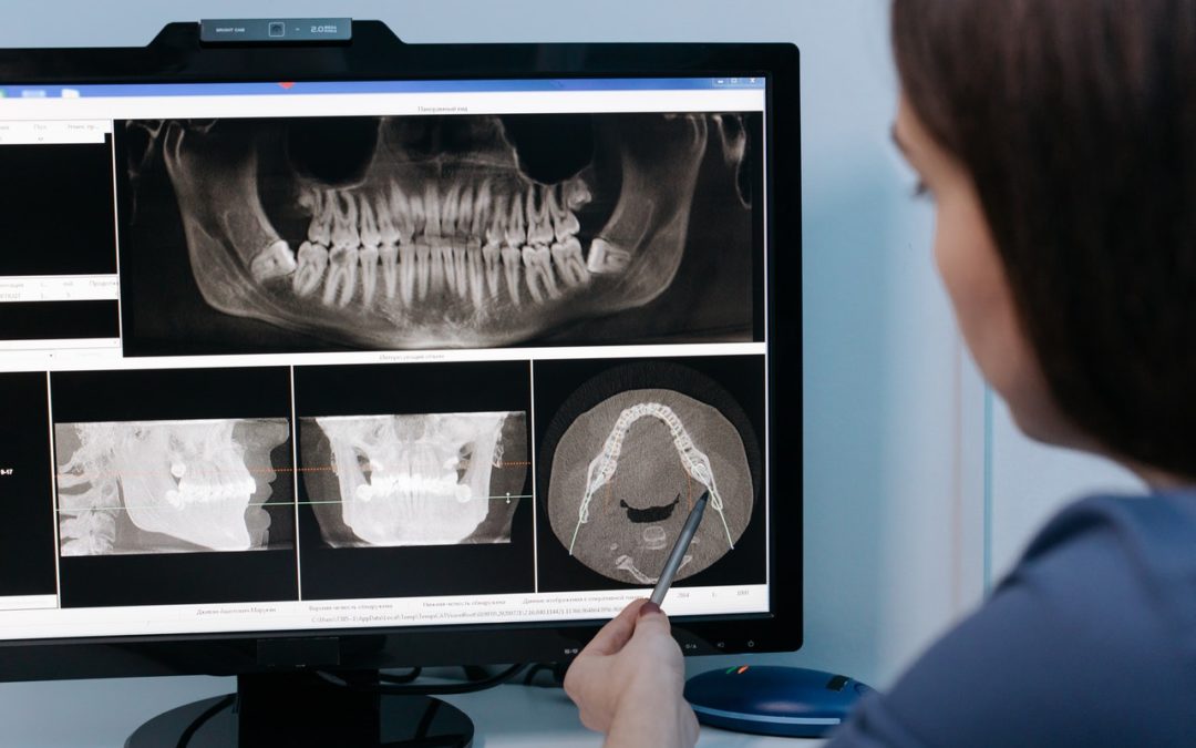 Why Digital X-rays Shouldn’t Be Scary